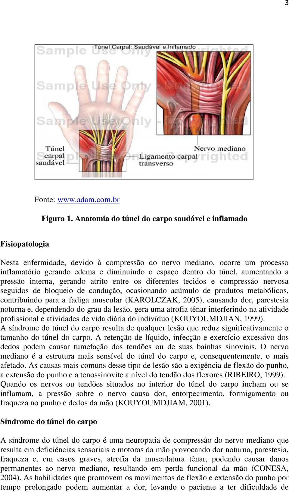 túnel, aumentando a pressão interna, gerando atrito entre os diferentes tecidos e compressão nervosa seguidos de bloqueio de condução, ocasionando acúmulo de produtos metabólicos, contribuindo para a