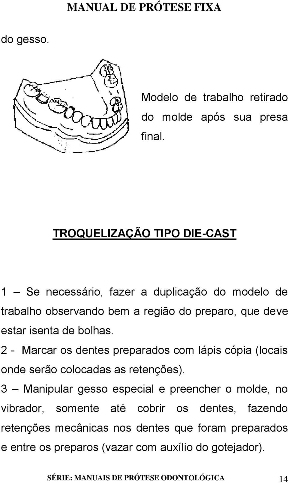 isenta de bolhas. 2 - Marcar os dentes preparados com lápis cópia (locais onde serão colocadas as retenções).