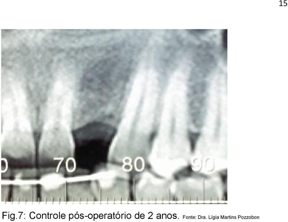 anos. Fonte: Dra.