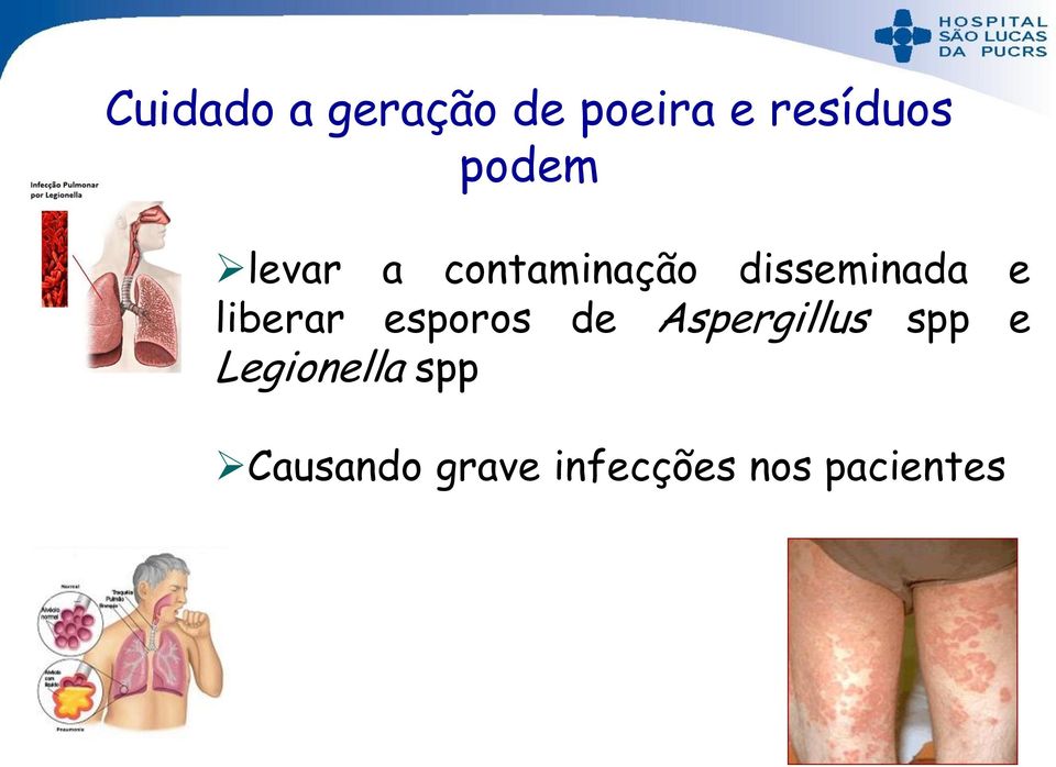 liberar esporos de Aspergillus spp e