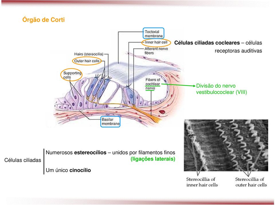 (VIII) Células ciliadas Numerosos estereocílios unidos