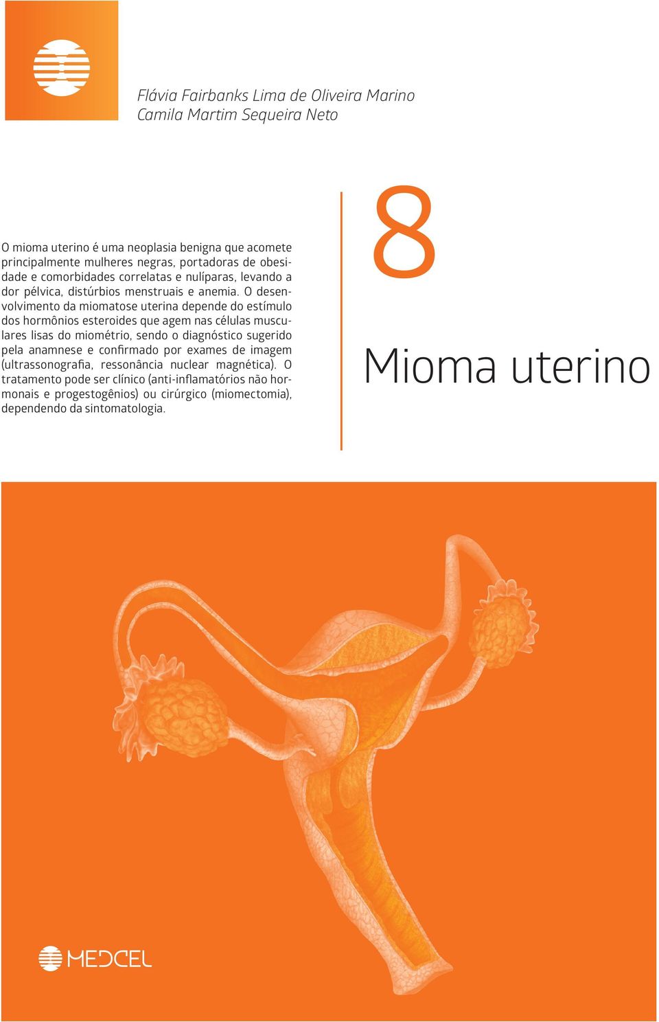 O desenvolvimento da miomatose uterina depende do estímulo dos hormônios esteroides que agem nas células musculares lisas do miométrio, sendo o diagnóstico sugerido pela