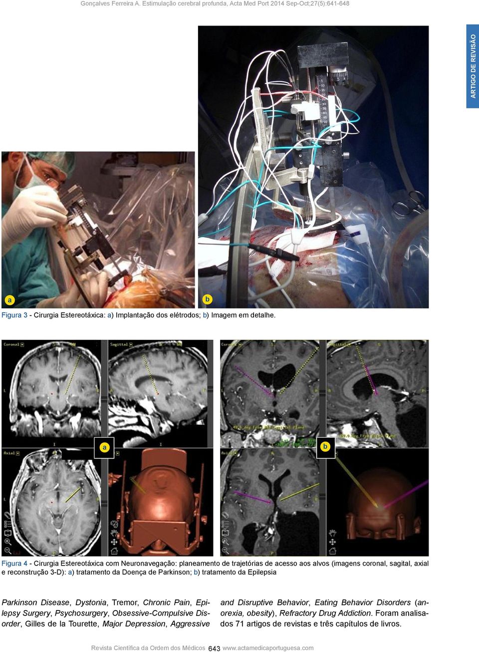 Doença de Parkinson; b) tratamento da Epilepsia Parkinson Disease, Dystonia, Tremor, Chronic Pain, Epilepsy Surgery, Psychosurgery, Obsessive-Compulsive Disorder, Gilles de la