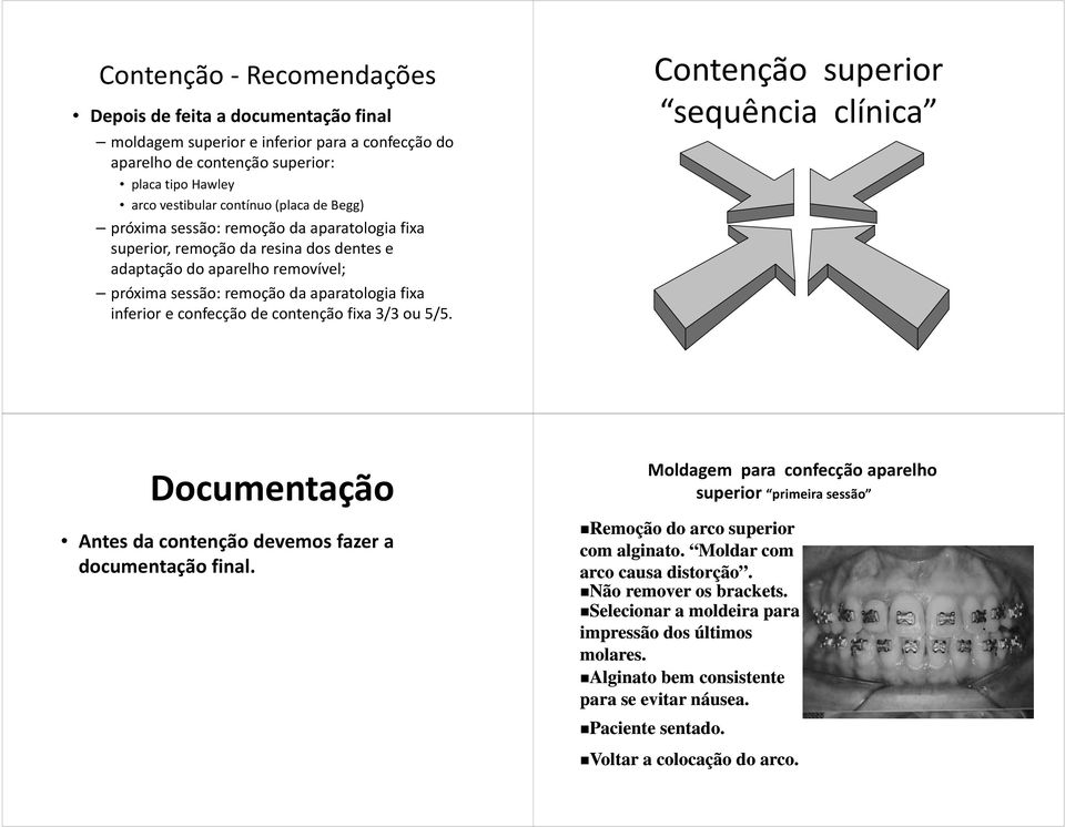 confecção de contenção fixa 3/3 ou 5/5. Contenção superior sequência clínica Documentação Antes da contenção devemos fazer a documentação final.