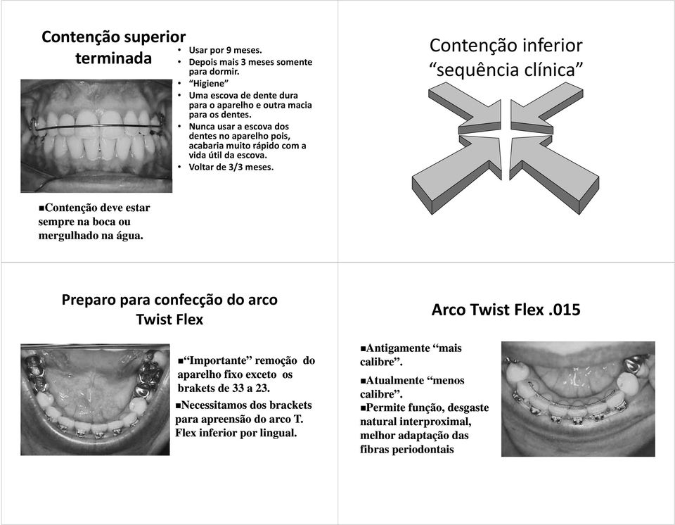 Contenção inferior sequência clínica Contenção deve estar sempre na boca ou mergulhado na água.