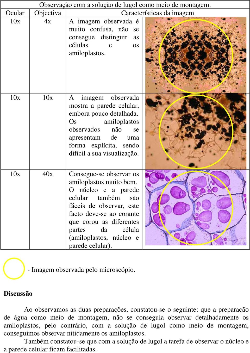 10x 40x Consegue-se observar os amiloplastos muito bem.