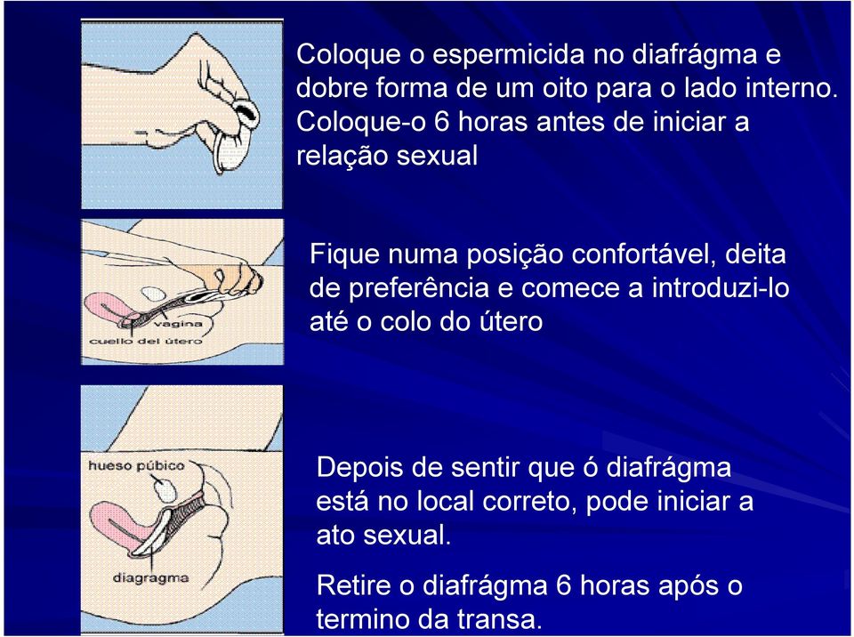 de preferência e comece a introduzi-lo até o colo do útero Depois de sentir que ó diafrágma