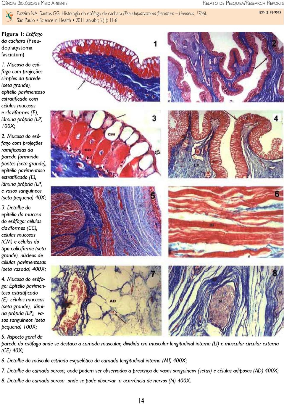 Mucosa do esôfago com projeções ramificadas da parede formando pontes (seta grande), epitélio pavimentoso estratificado (E), lâmina própria (LP) e vasos sanguíneos (seta pequena) 40X; 3.