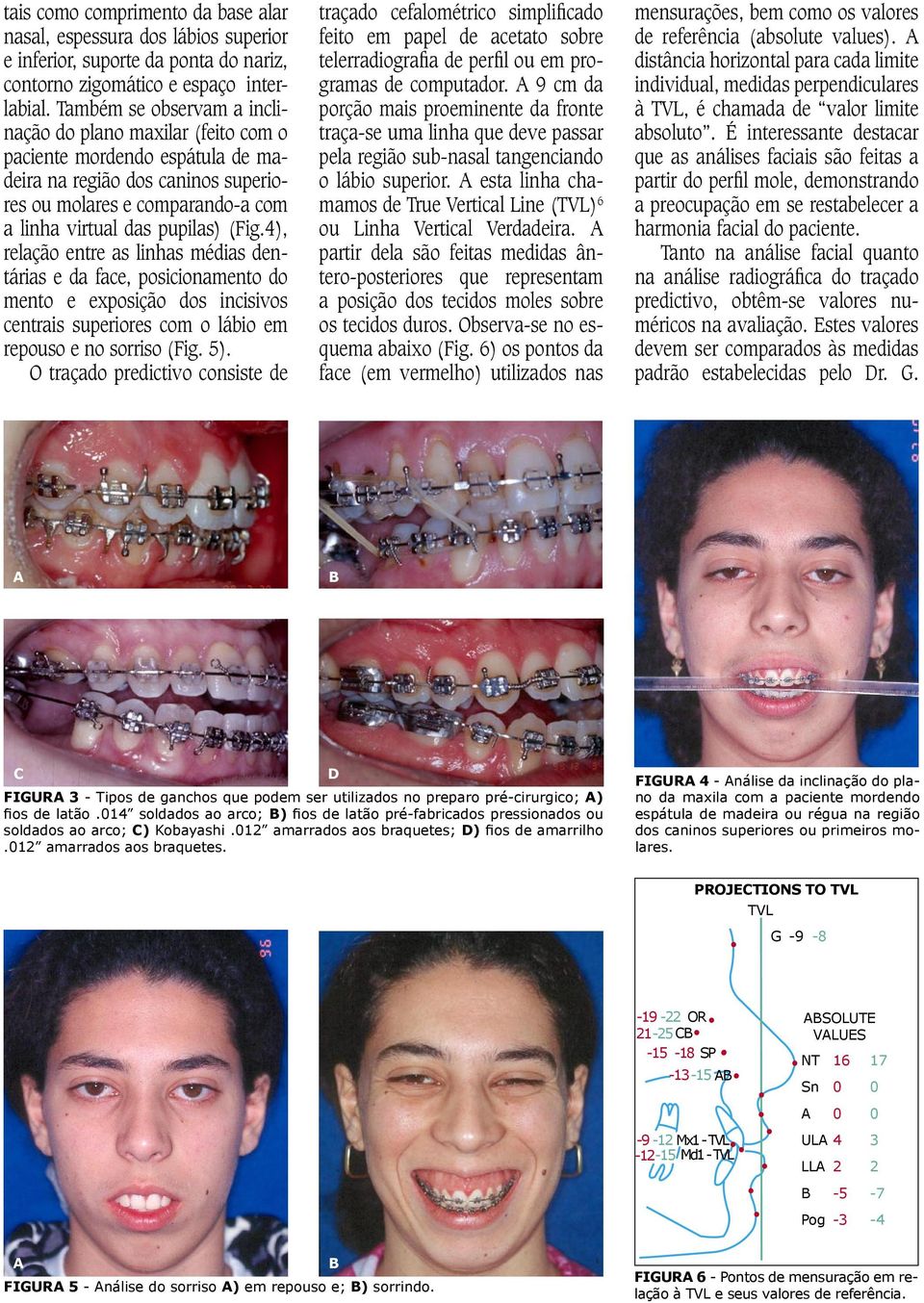 4), relação entre as linhas médias dentárias e da face, posicionamento do mento e exposição dos incisivos centrais superiores com o lábio em repouso e no sorriso (Fig. 5).