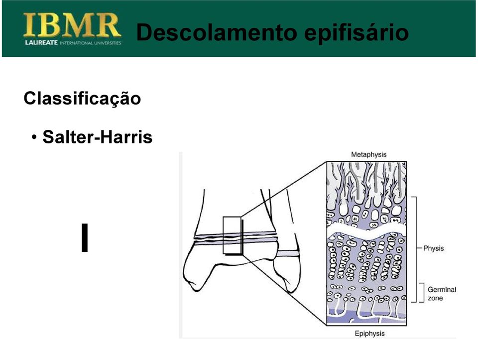 Classificação