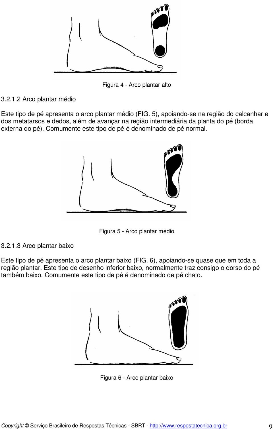 Comumente este tipo de pé é denominado de pé normal. 3.2.1.3 Arco plantar baixo Figura 5 - Arco plantar médio Este tipo de pé apresenta o arco plantar baixo (FIG.