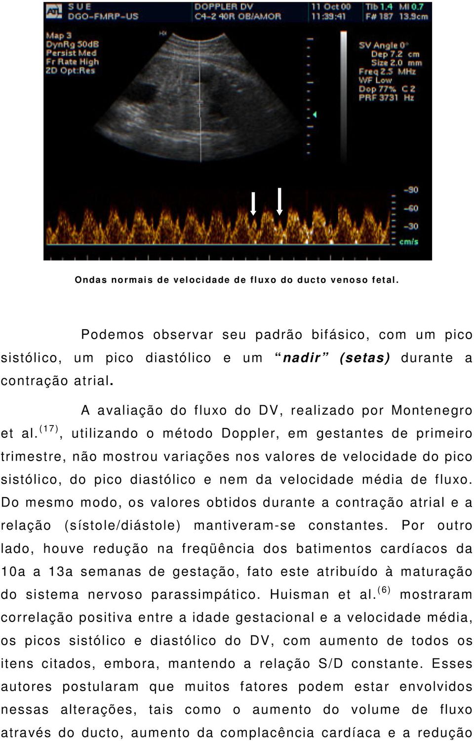 (17 ), utilizando o método Doppler, em gestantes de primeiro trimestre, não mostrou variações nos valores de velocidade do pico sistólico, do pico diastólico e nem da velocidade média de fluxo.