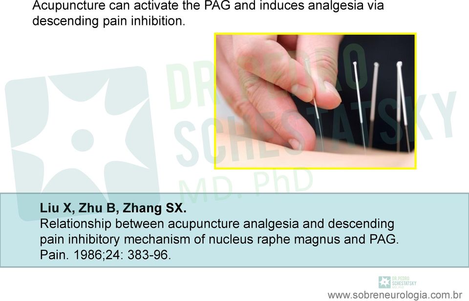 Relationship between acupuncture analgesia and descending pain