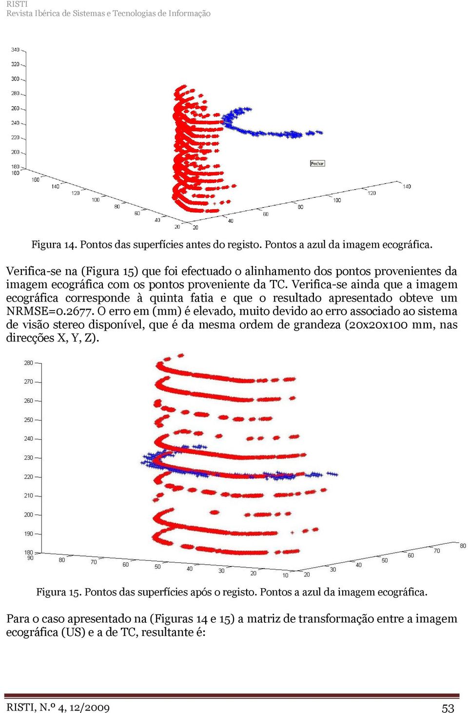 Verifica-se ainda que a imagem ecográfica corresponde à quinta fatia e que o resultado apresentado obteve um NRMSE=0.2677.