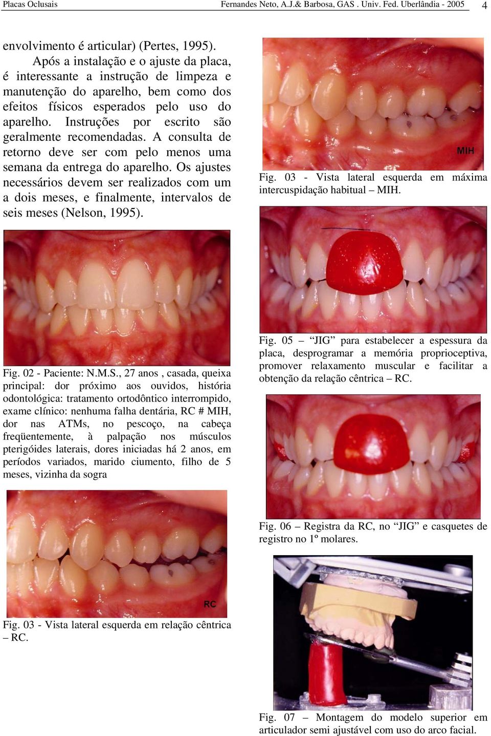 Instruções por escrito são geralmente recomendadas. A consulta de retorno deve ser com pelo menos uma semana da entrega do aparelho.