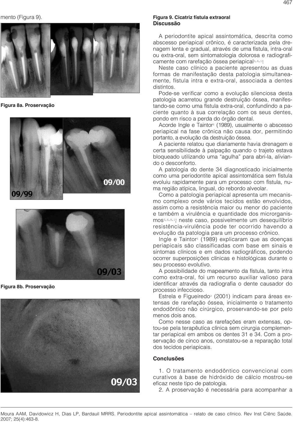 ou extra-oral, sem sintomatologia dolorosa e radiograficamente com rarefação óssea periapical 3,6,10.