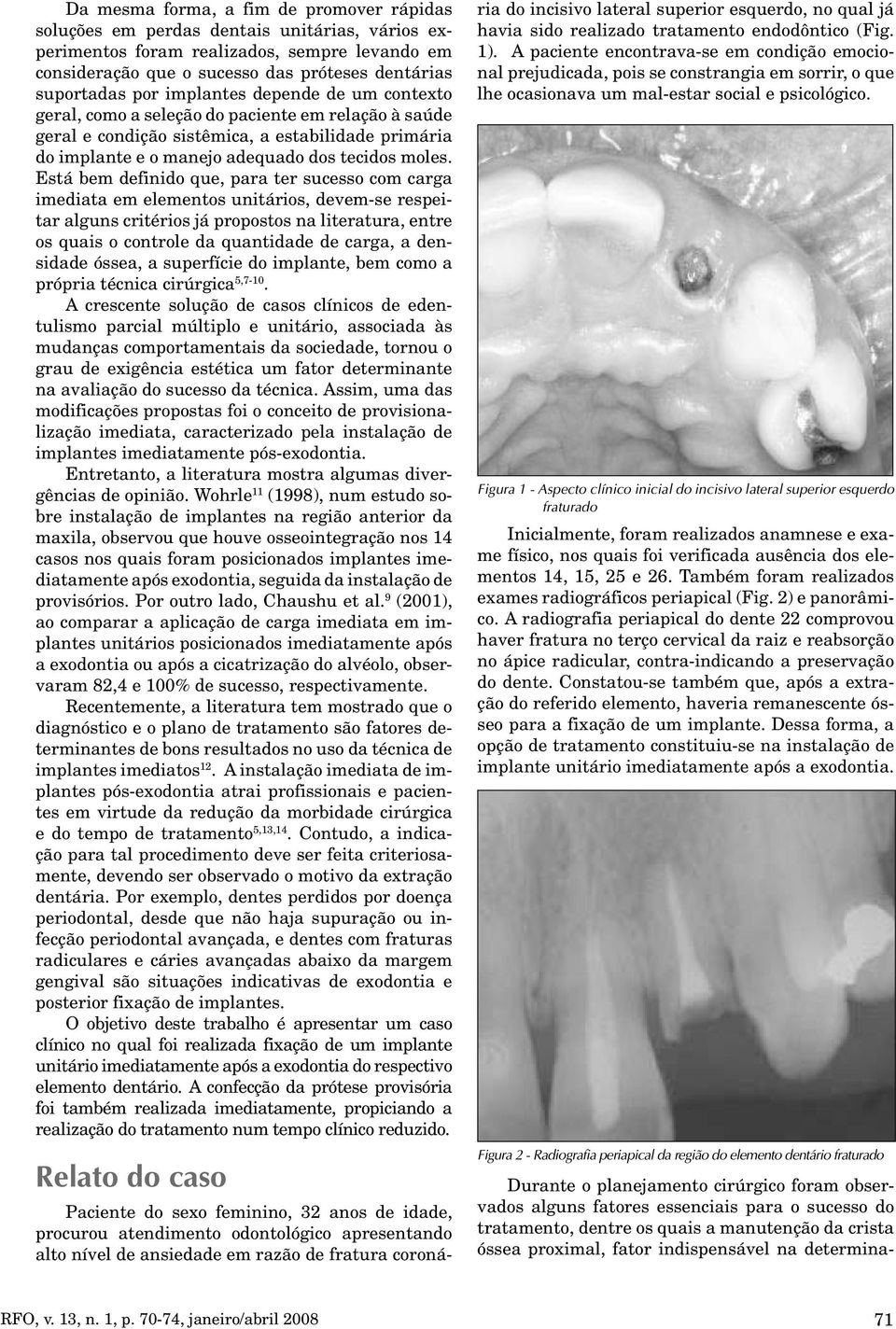 Está bem definido que, para ter sucesso com carga imediata em elementos unitários, devem-se respeitar alguns critérios já propostos na literatura, entre os quais o controle da quantidade de carga, a