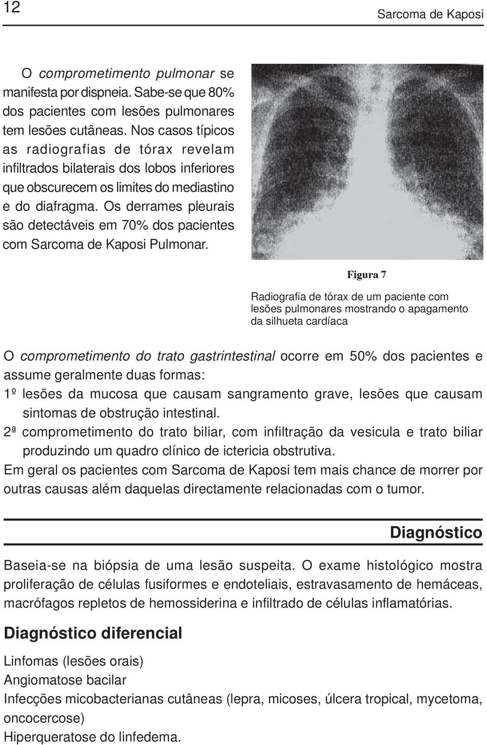 Os derrames pleurais são detectáveis em 70% dos pacientes com Sarcoma de Kaposi Pulmonar.