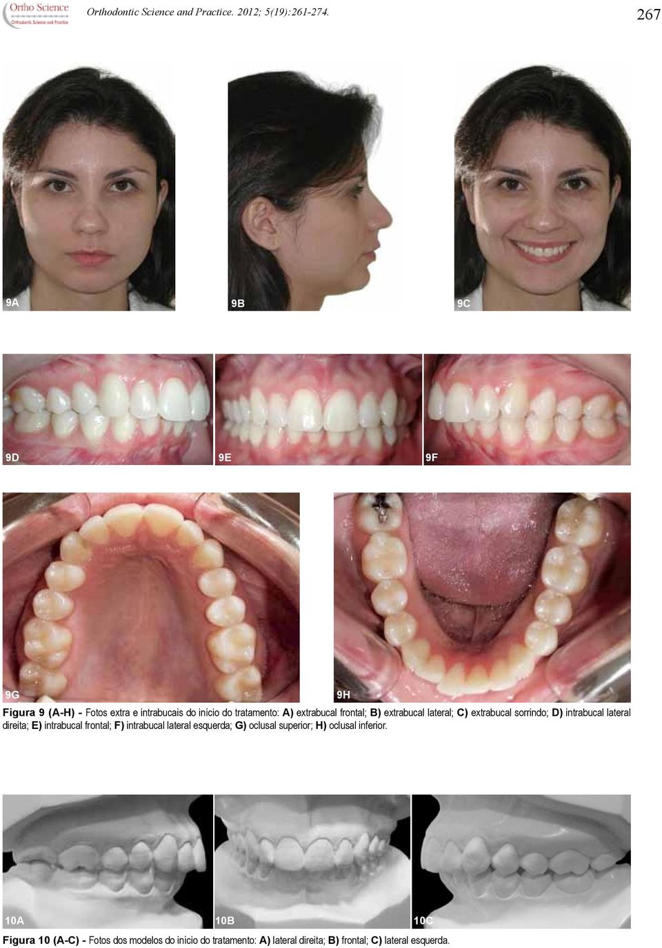 extrabucal lateral; C) extrabucal sorrindo; D) intrabucal lateral direita; E) intrabucal frontal; F) intrabucal