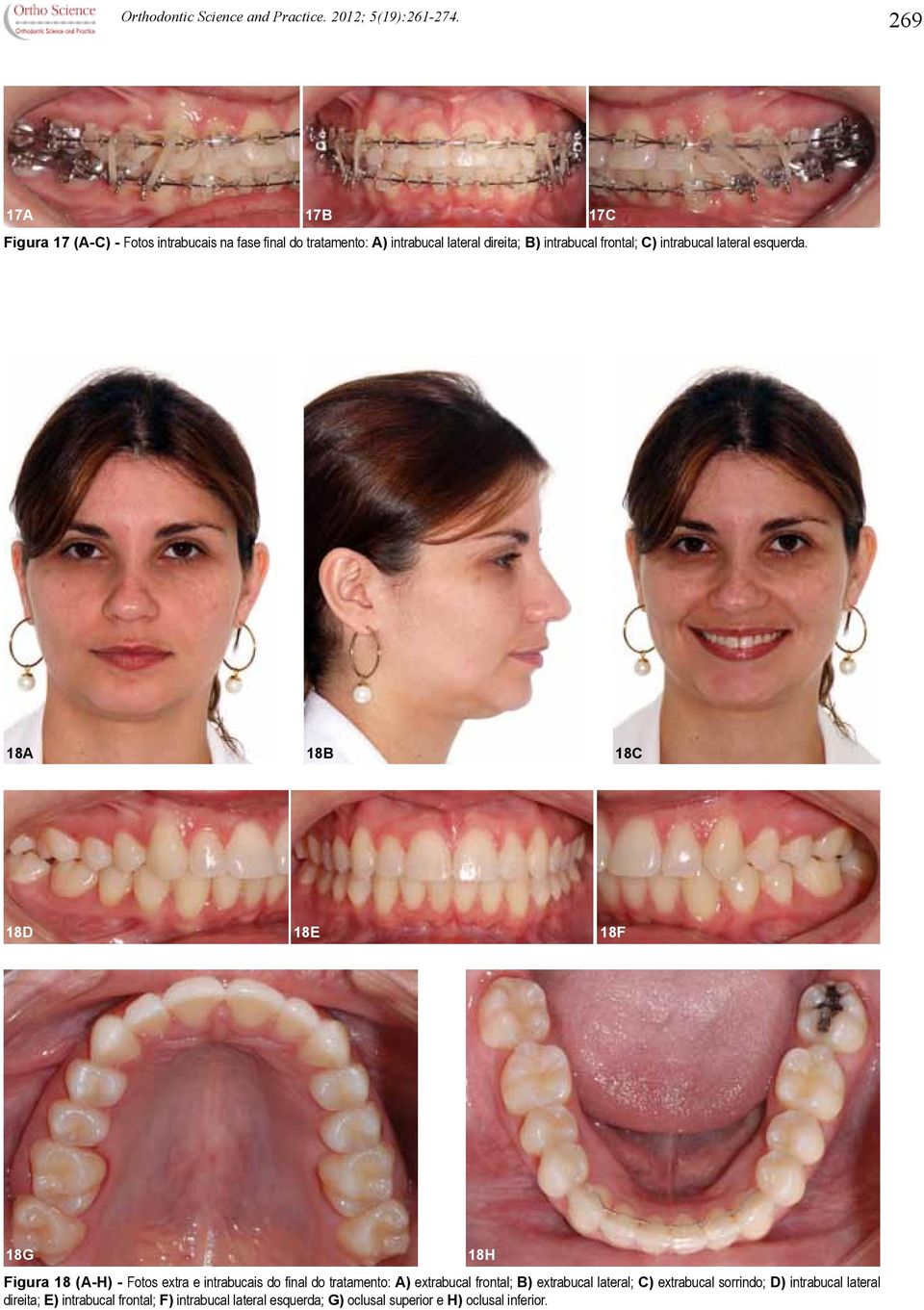 frontal; C) intrabucal lateral esquerda.