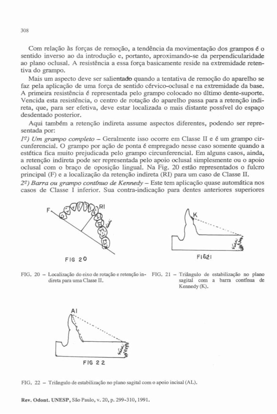 Mais um aspecto deve er alientado quando a tentativa de remoção do aparelho se faz pela aplicação de uma força de sentido cérvico-oclusal e na extremidade da base.