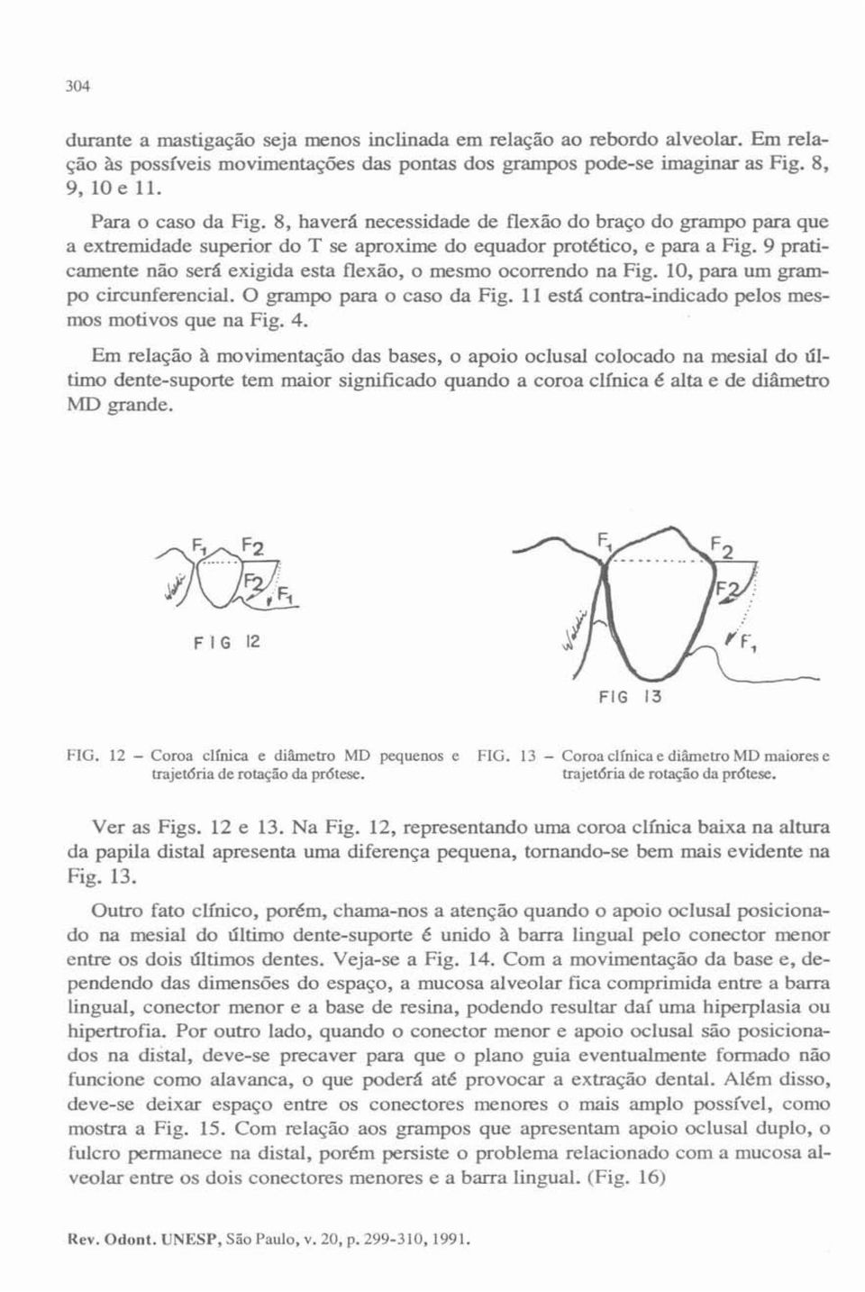 o mesmo ocorrendo na Fig. 10. para um grampo circunferencial. O grampo para o caso da Fig. 1J está contra-indicado pelos mesmos motivos que na Fig. 4. Em relação à movimentação das bases.