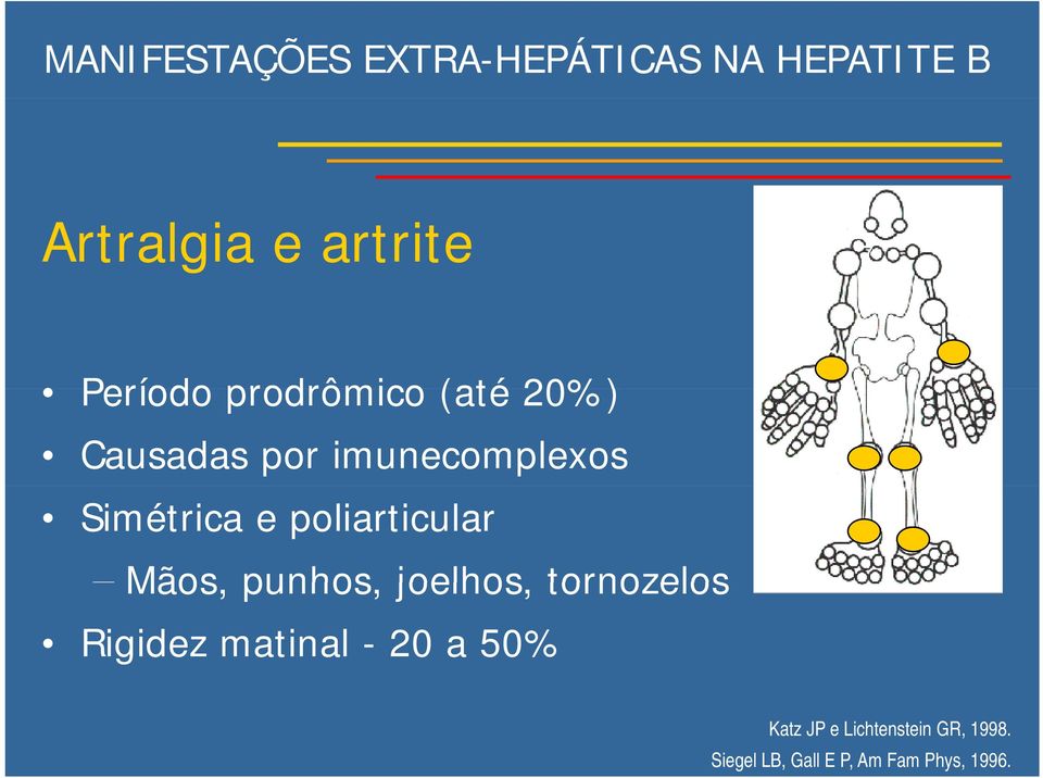 poliarticular Mãos, punhos, joelhos, tornozelos Rigidez matinal - 20 a