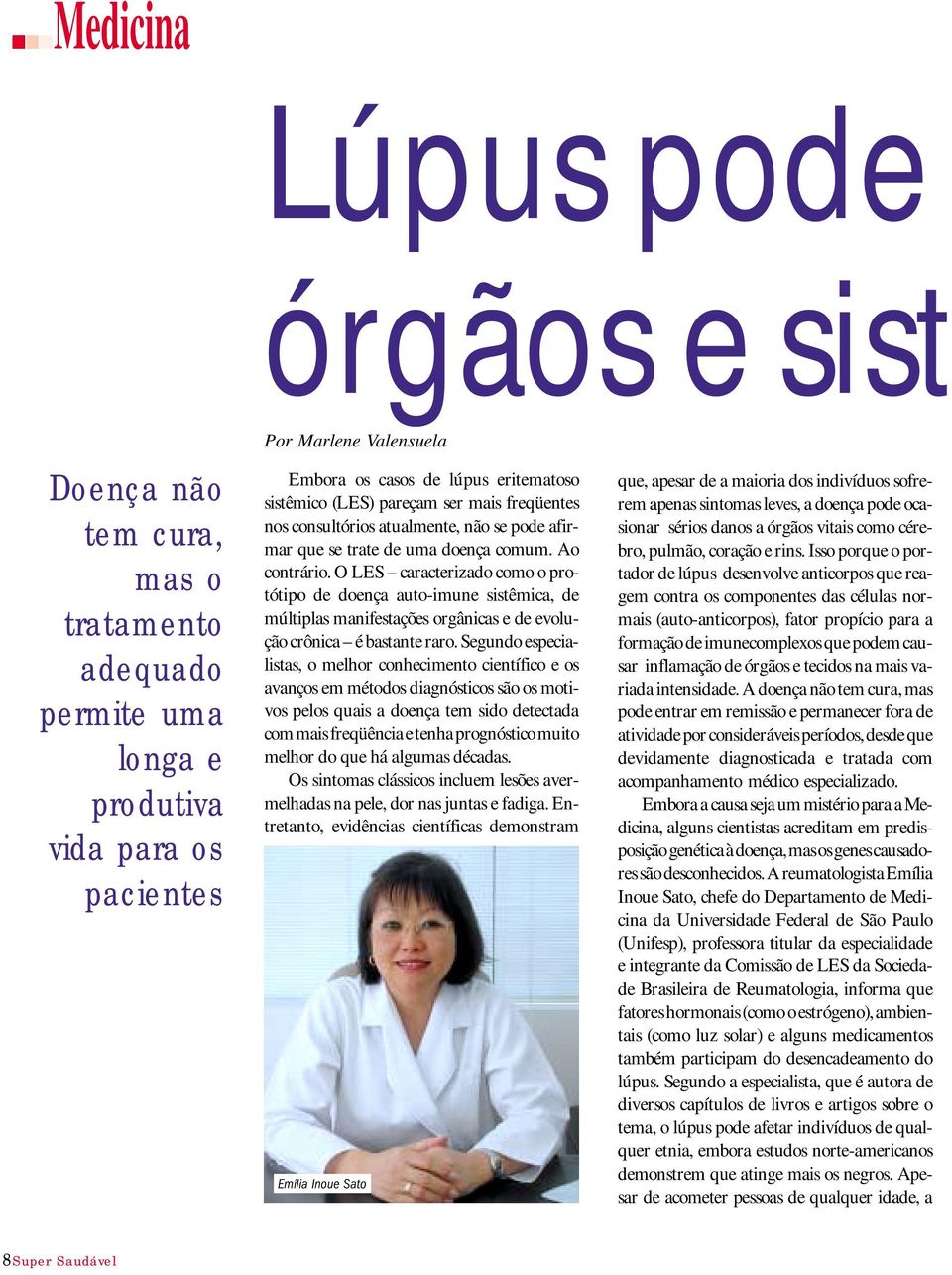 O LES caracterizado como o protótipo de doença auto-imune sistêmica, de múltiplas manifestações orgânicas e de evolução crônica é bastante raro.