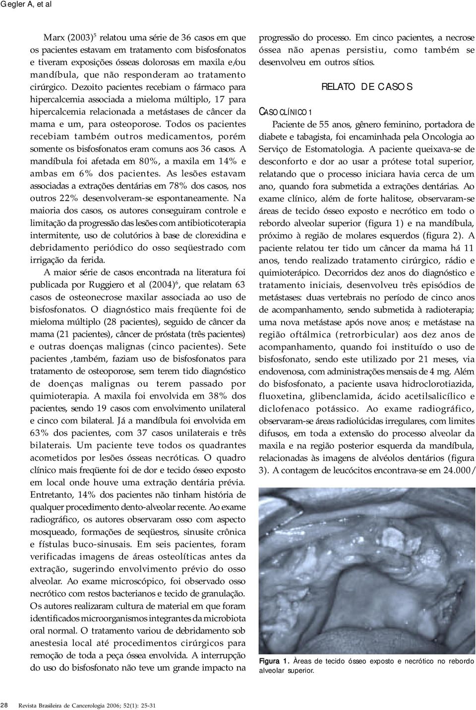 Dezoito pacientes recebiam o fármaco para hipercalcemia associada a mieloma múltiplo, 17 para hipercalcemia relacionada a metástases de câncer da mama e um, para osteoporose.