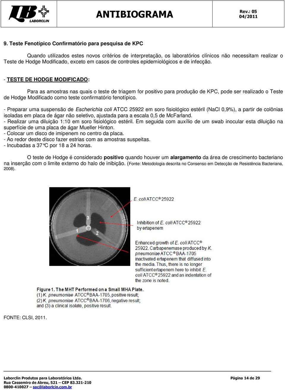 - TESTE DE HODGE MODIFICADO: Para as amostras nas quais o teste de triagem for positivo para produção de KPC, pode ser realizado o Teste de Hodge Modificado como teste confirmatório fenotípico.