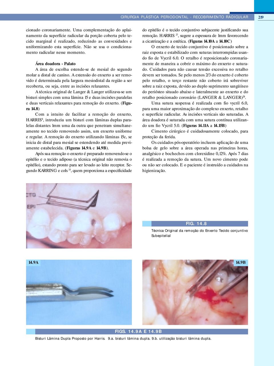 Não se usa o condicionamento radicular nesse momento. Área doadora - Palato A área de escolha estende-se de mesial do segundo molar a distal de canino.