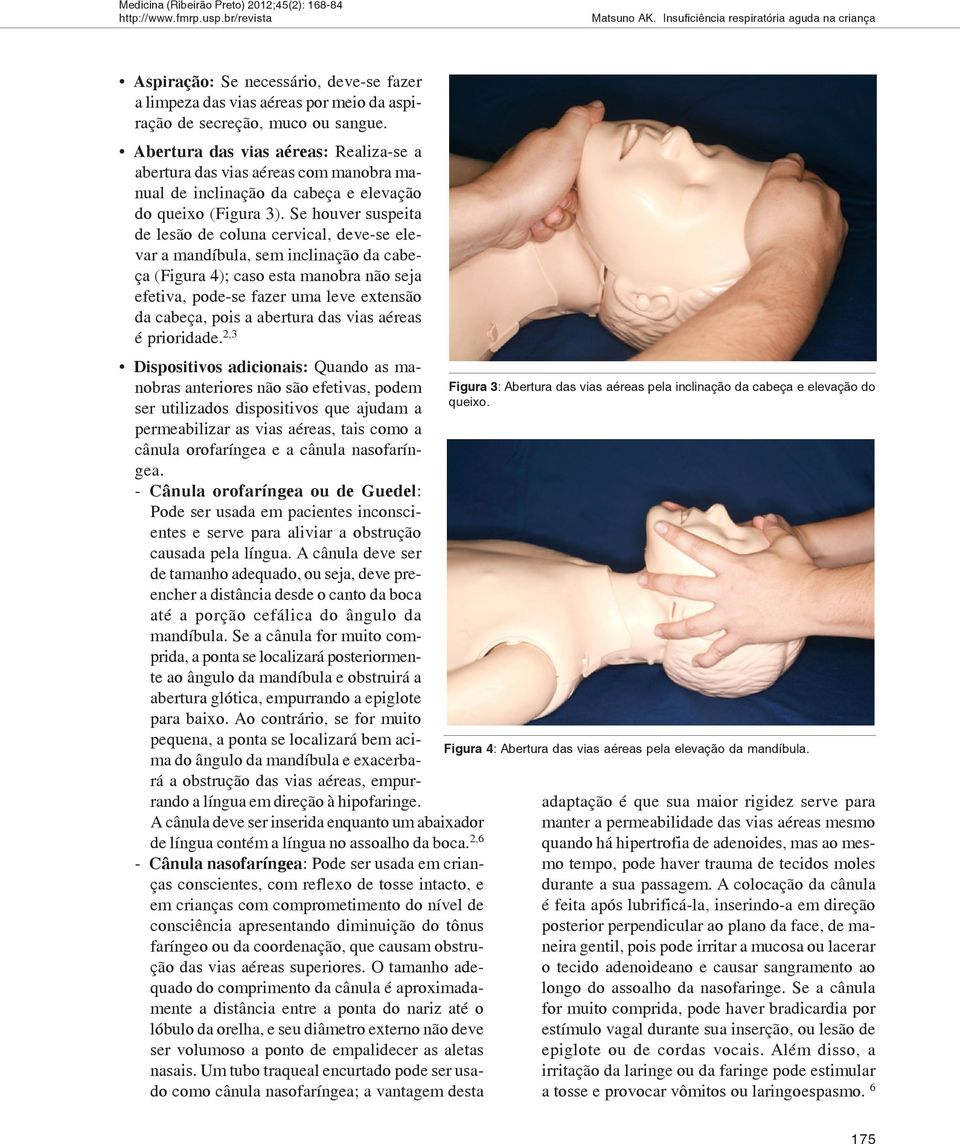 Se houver suspeita de lesão de coluna cervical, deve-se elevar a mandíbula, sem inclinação da cabeça (Figura 4); caso esta manobra não seja efetiva, pode-se fazer uma leve extensão da cabeça, pois a