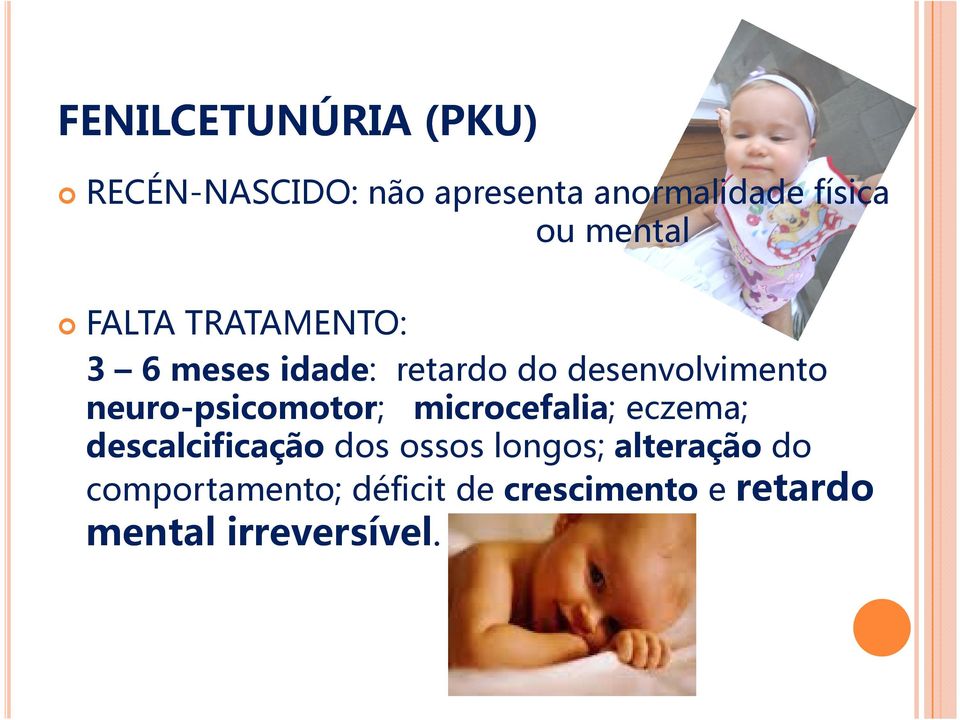 neuro-psicomotor; microcefalia; eczema; descalcificação dos ossos longos;