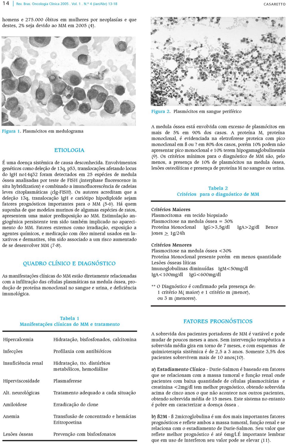 Envolvimentos genéticos como deleção de 13q, p53, translocações afetando locus do IgH no14q32 foram detectados em 25 espécies de medula óssea analisadas por teste de FISH (interphase fluorescence in