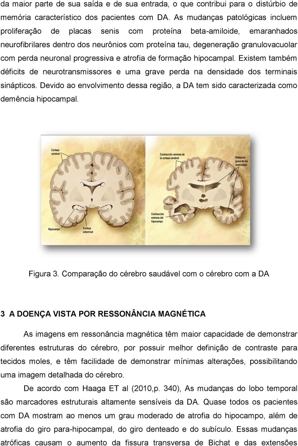 neuronal progressiva e atrofia de formação hipocampal. Existem também déficits de neurotransmissores e uma grave perda na densidade dos terminais sinápticos.