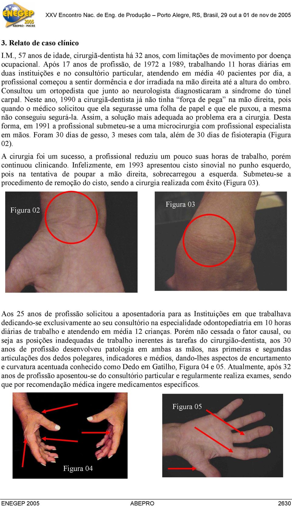 dormência e dor irradiada na mão direita até a altura do ombro. Consultou um ortopedista que junto ao neurologista diagnosticaram a síndrome do túnel carpal.