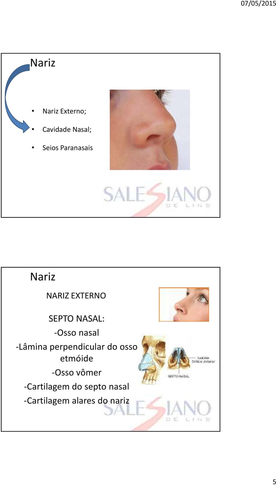 nasal -Lâmina perpendicular do osso etmóide -Osso