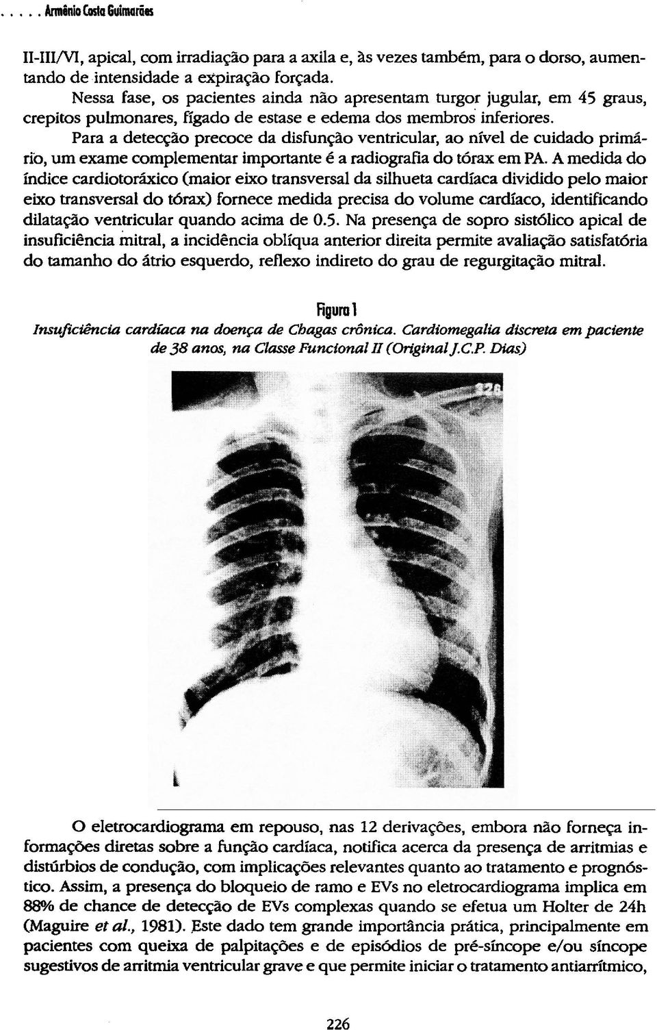 Para a detecção precoce da disfunção ventricular, ao nível de cuidado primário, um exame complementar importante é a radiografia do tórax em PA.