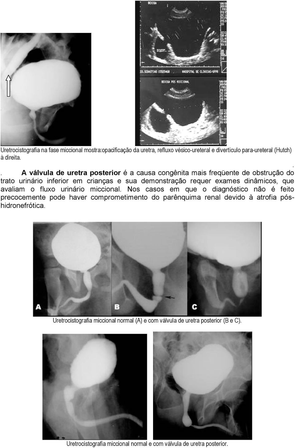 dinâmicos, que avaliam o fluxo urinário miccional.