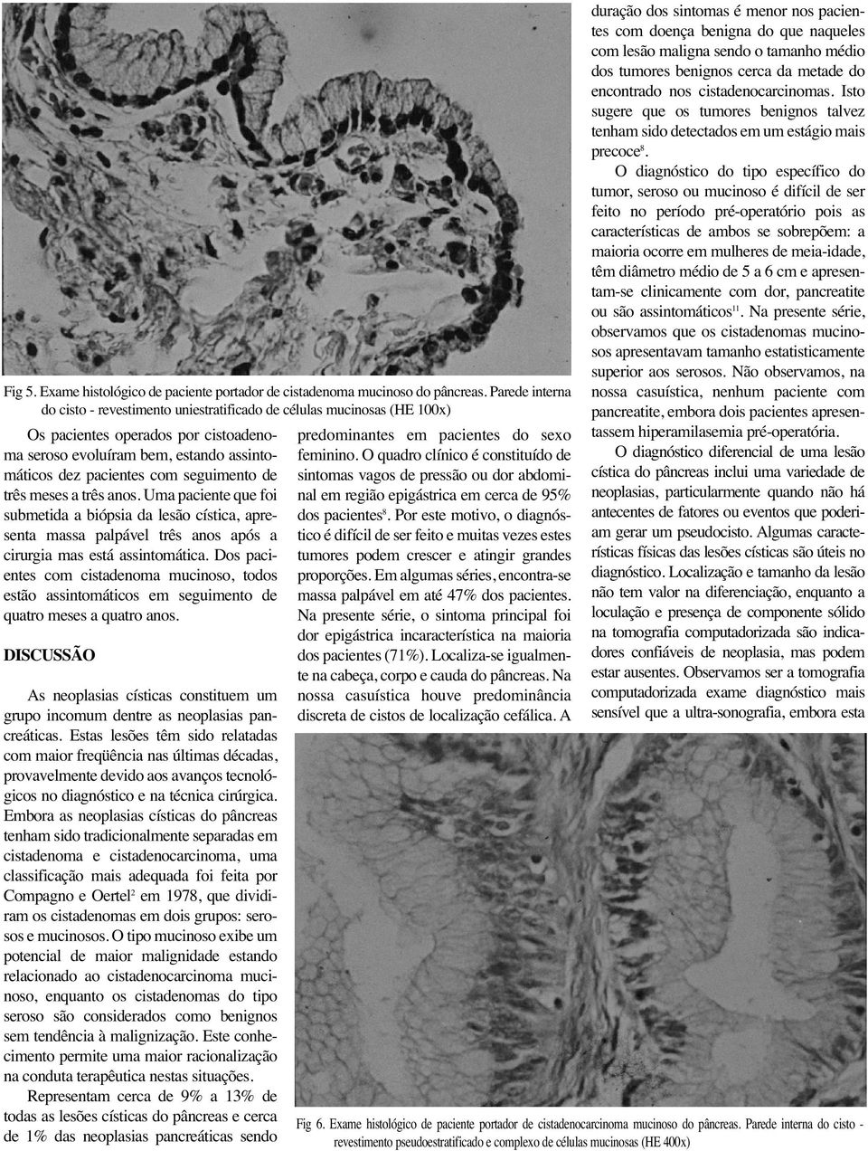 de três meses a três anos. Uma paciente que foi submetida a biópsia da lesão cística, apresenta massa palpável três anos após a cirurgia mas está assintomática.