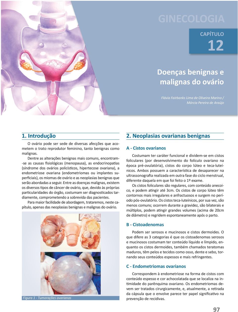 Dentre as alterações benignas mais comuns, encontram- -se as causas fisiológicas (menopausa), as endocrinopatias (síndrome dos ovários policísticos, hipertecose ovariana), a endometriose ovariana