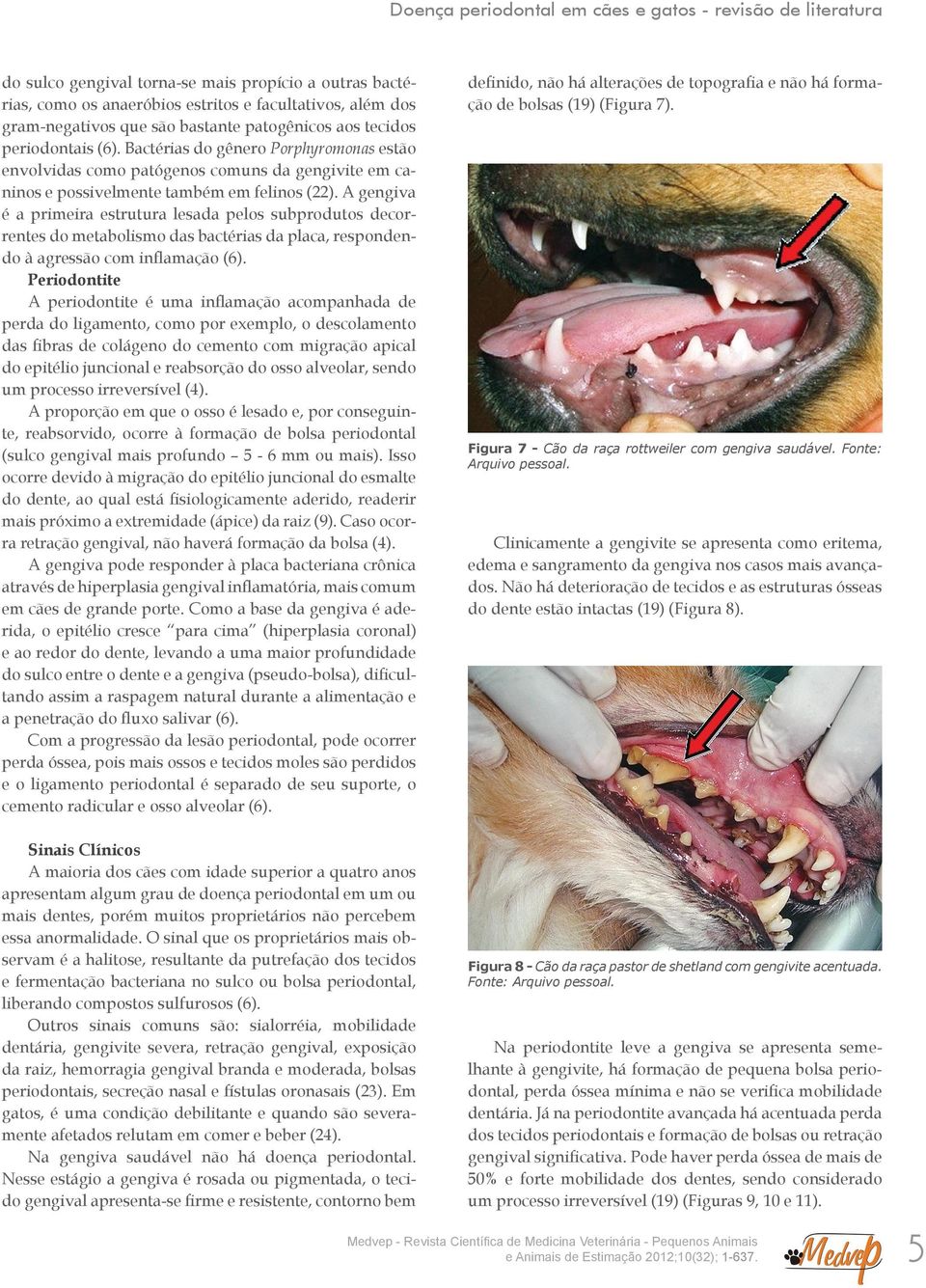 A gengiva é a primeira estrutura lesada pelos subprodutos decorrentes do metabolismo das bactérias da placa, respondendo à agressão com inflamação (6).