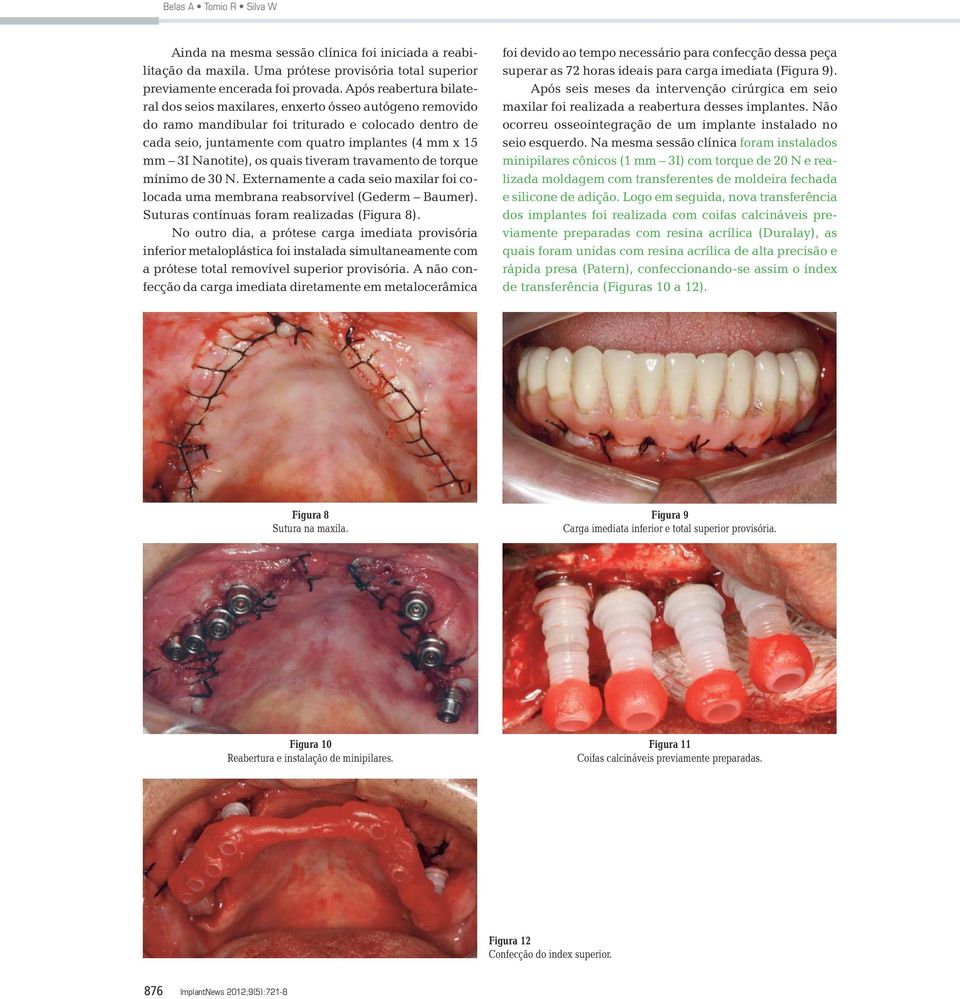 Nanotite), os quais tiveram travamento de torque mínimo de 30 N. Externamente a cada seio maxilar foi colocada uma membrana reabsorvível (Gederm Baumer). Suturas contínuas foram realizadas (Figura 8).