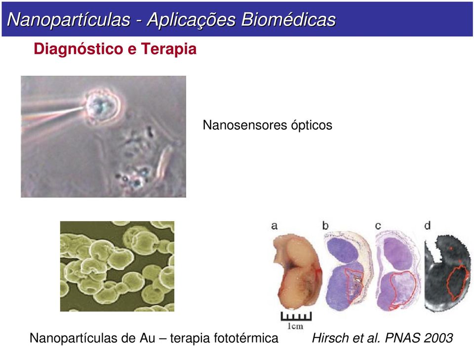 Nanosensores ópticos Nanopartículas