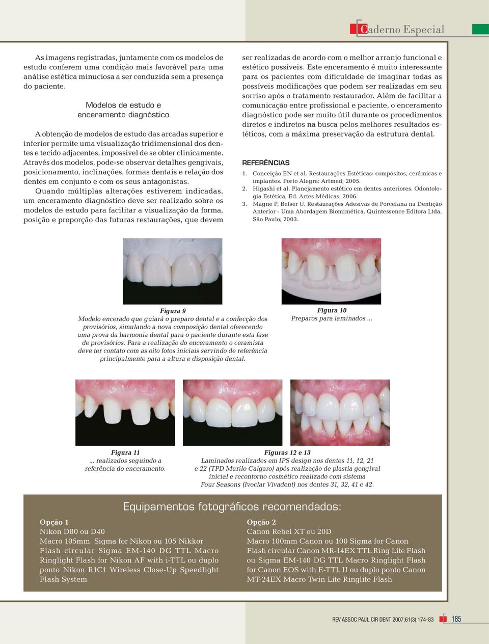 obter clinicamente. Através dos modelos, pode-se observar detalhes gengivais, posicionamento, inclinações, formas dentais e relação dos dentes em conjunto e com os seus antagonistas.