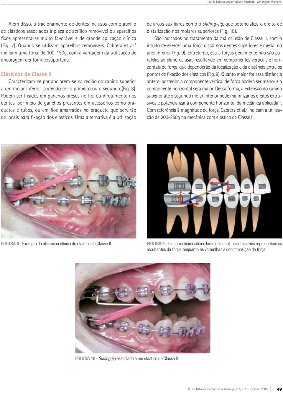 muito favorável e de grande aplicação clínica (Fig. 7). Quando se utilizam aparelhos removíveis, Cabrera et al.