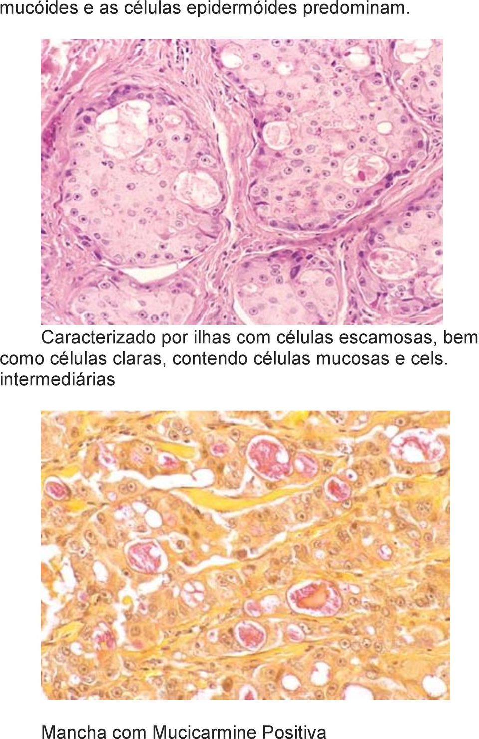 bem como células claras, contendo células mucosas