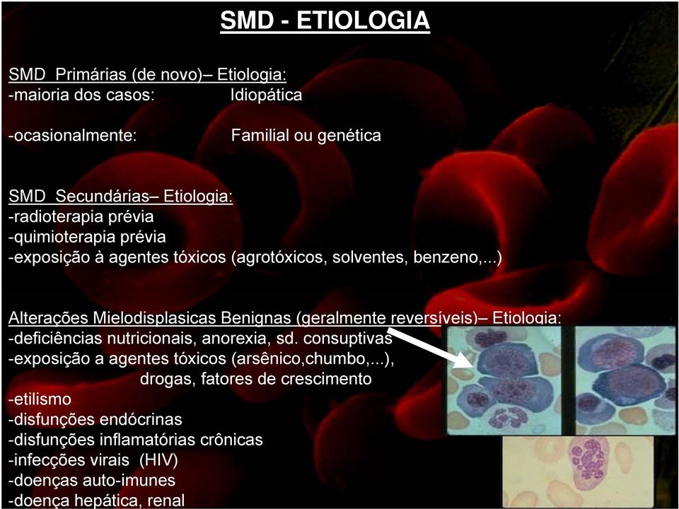 ..) Alterações Mielodisplasicas Benignas (geralmente reversíveis) Etiologia: -deficiências nutricionais, anorexia, sd.