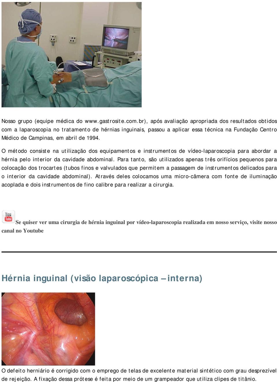 O método consiste na utilização dos equipamentos e instrumentos de vídeo-laparoscopia para abordar a hérnia pelo interior da cavidade abdominal.