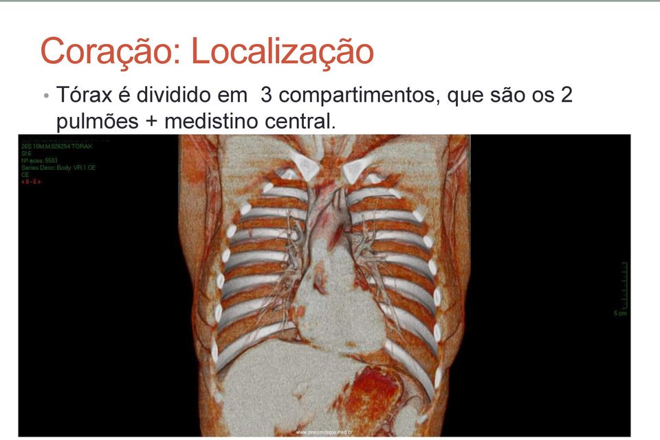 compartimentos, que são